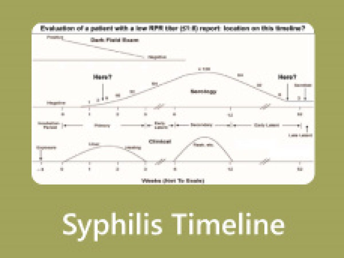 Men bir yuk mashinasi haydovchisining ogzini sorib oldim