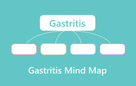 Gastrit aql xaritasi